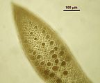 6 – Porzione apicale di un tetrasporofito con tetrasporocisti